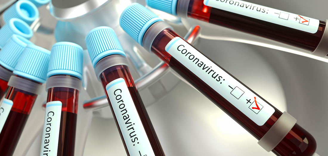 COVID-19: Maneuvering a New Reality and a Complex Moment